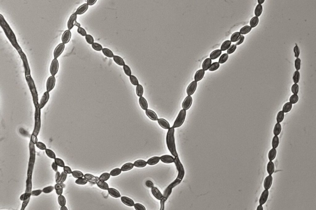 A Deadly Mold That Attacks the Brain Is on the Rise, and Scientists Aren’t Sure Why